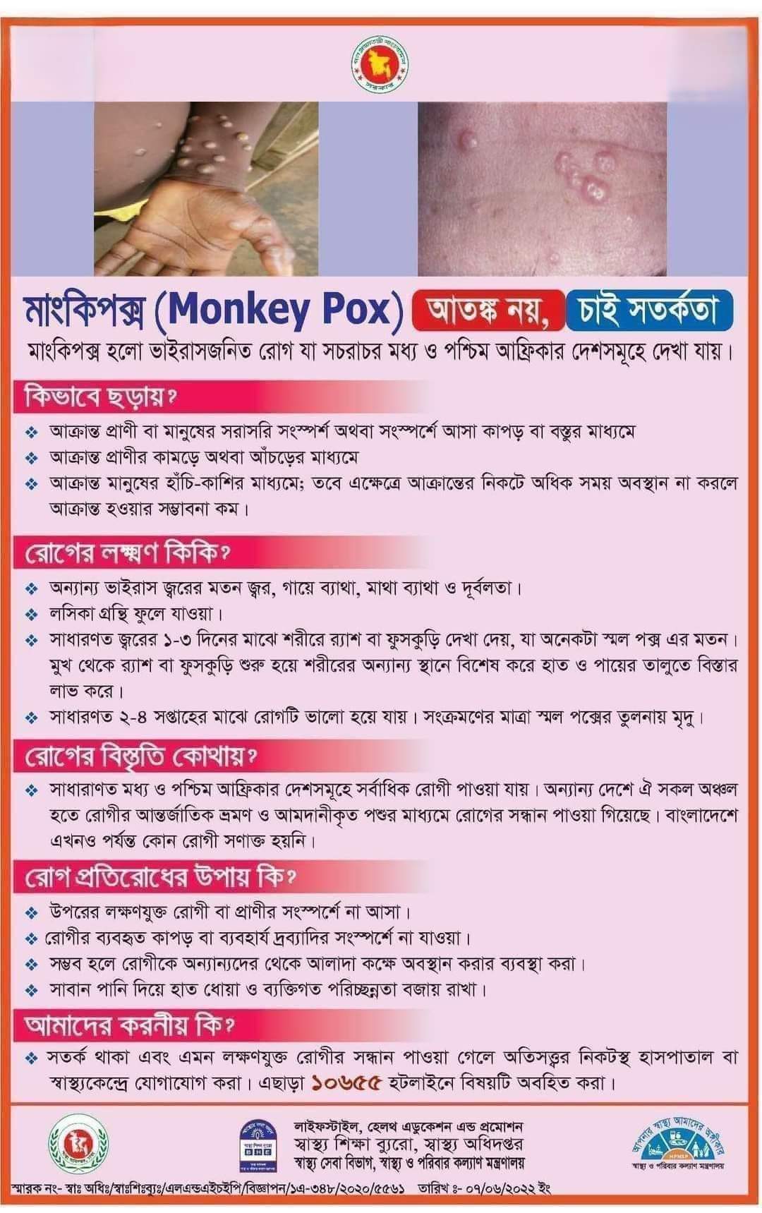 এমপক্স