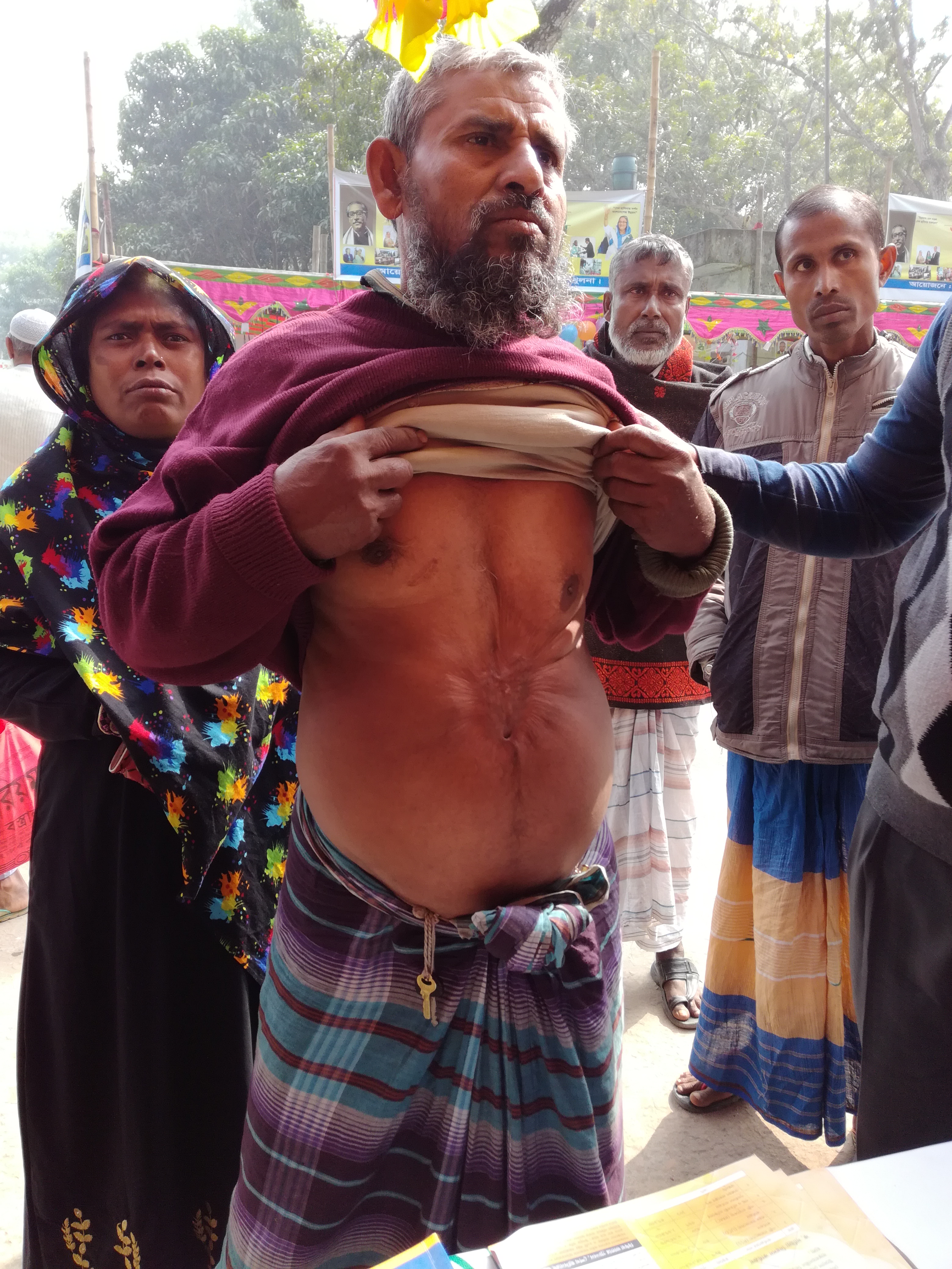 Service Process Simplification