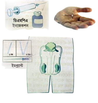 পরিবার পরিকল্পনা সেবা (স্থায়ী ও দীর্ঘমেয়াদী)