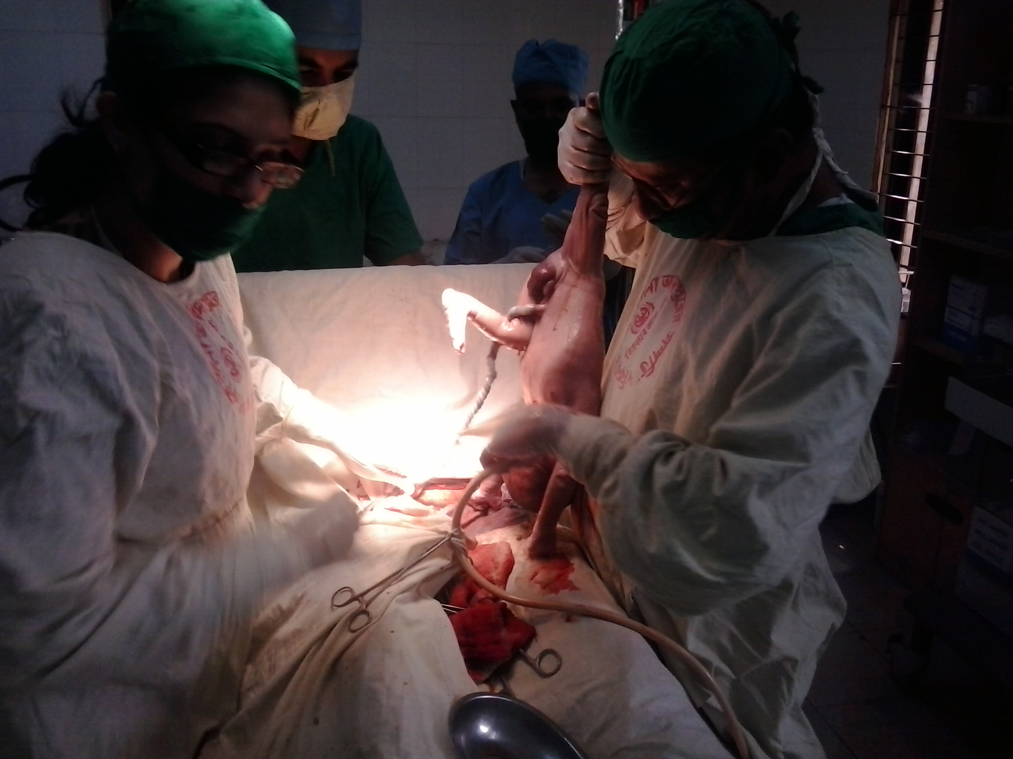 অপারেশন থিয়েটারে সিজারিয়ান অপারেশন 